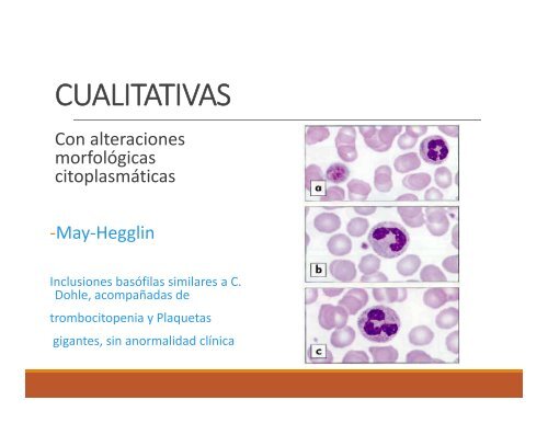 ALTERACIONES GENETICAS DE LEUCOCITOS woek