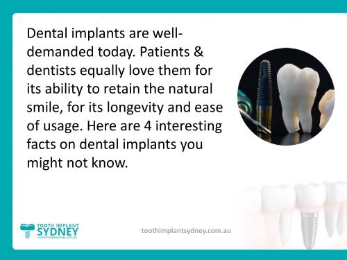 Surprising Facts on Dental Implants!