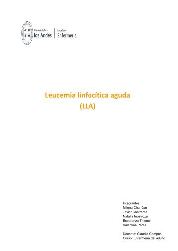 leucemia linfocítica aguda