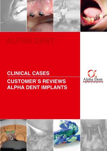 Alpha Dent Implants welcome book with customers reviews all over the world