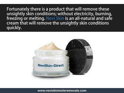 Mole Removal Cream