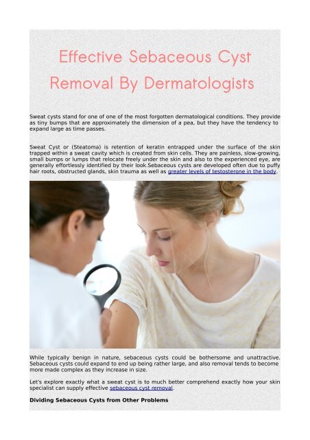 Effective Sebaceous Cyst Removal By Dermatologists