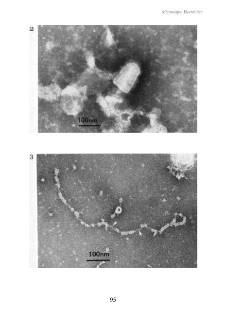 MICROSCOPIA ELECTRÓNICA