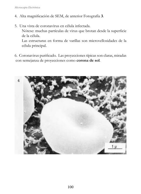 MICROSCOPIA ELECTRÓNICA