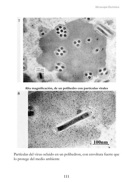 MICROSCOPIA ELECTRÓNICA