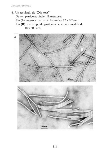 MICROSCOPIA ELECTRÓNICA