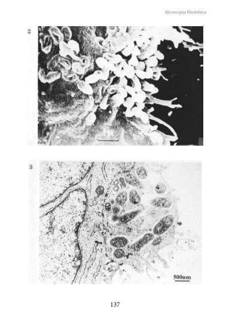 MICROSCOPIA ELECTRÓNICA