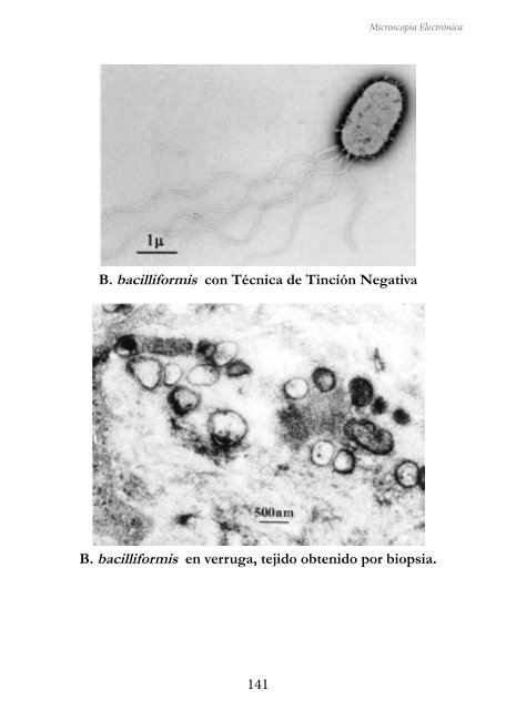 MICROSCOPIA ELECTRÓNICA