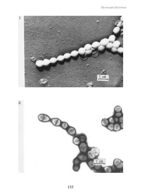 MICROSCOPIA ELECTRÓNICA