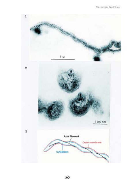 MICROSCOPIA ELECTRÓNICA