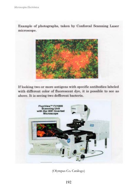 MICROSCOPIA ELECTRÓNICA