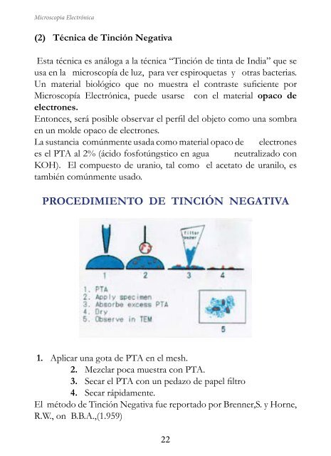 MICROSCOPIA ELECTRÓNICA