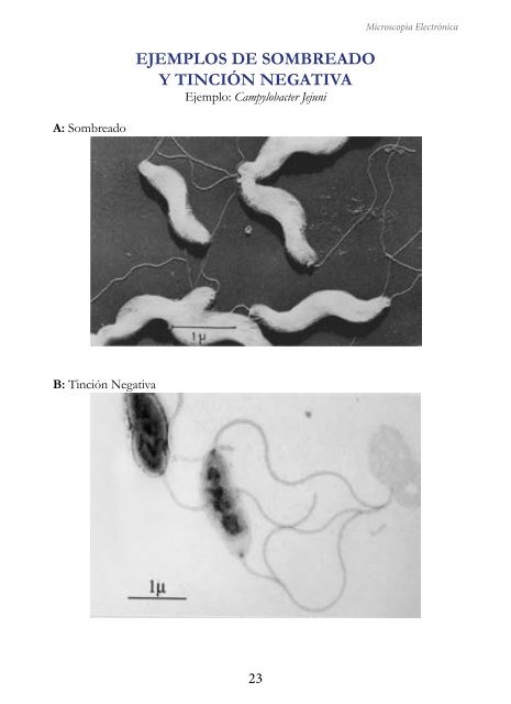 MICROSCOPIA ELECTRÓNICA