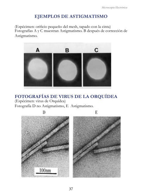 MICROSCOPIA ELECTRÓNICA