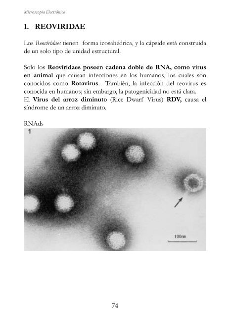 MICROSCOPIA ELECTRÓNICA