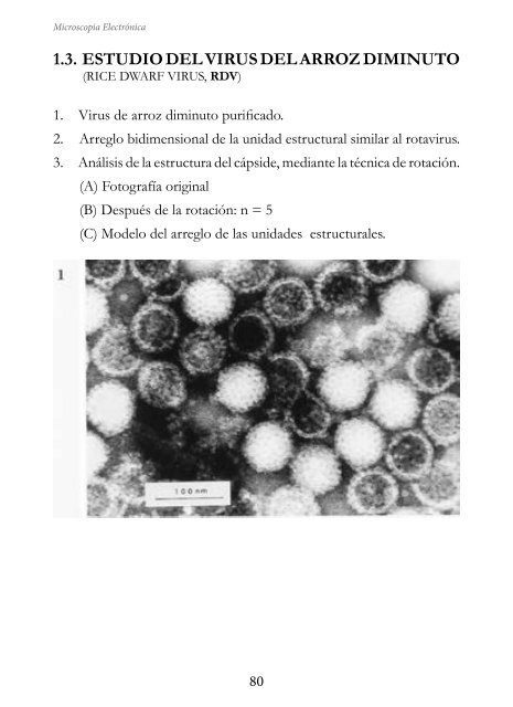 MICROSCOPIA ELECTRÓNICA