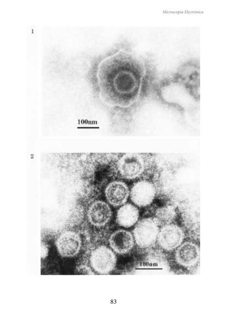 MICROSCOPIA ELECTRÓNICA