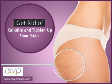 The Role Skin Tightening in Cellulite Reduction
