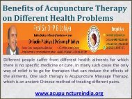 Benefits of Acupuncture Therapy