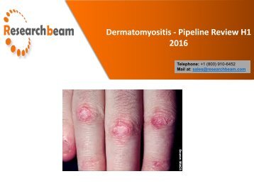 Dermatomyositis Causes and Symptoms – Overview