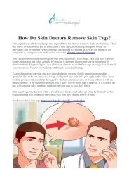 How Do Skin Doctors Remove Skin Tags?