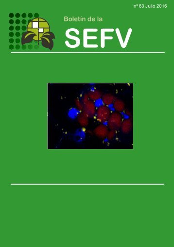 SEFV