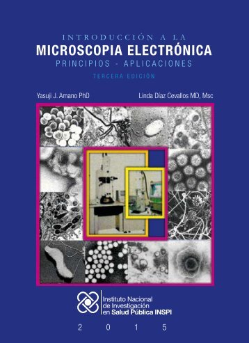 MICROSCOPIA ELECTRÓNICA