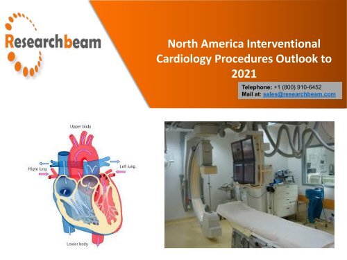 North America Interventional Cardiology Procedures Outlook to 2021