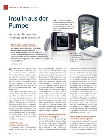 Insulin aus der Pumpe - medicum Hamburg