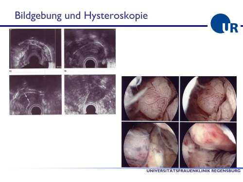 Diagnostik und Therapie von Blutungsstörungen