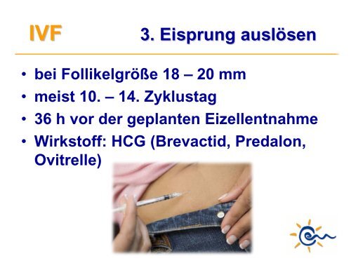 Was ist IVF - Kinderwunsch Praxis Tübingen