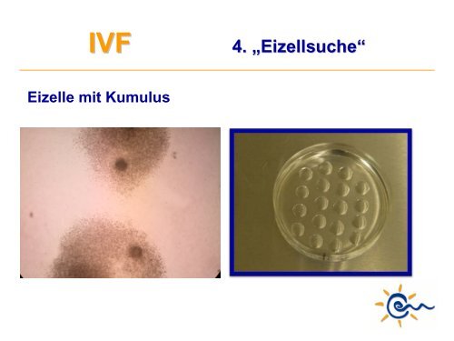 Was ist IVF - Kinderwunsch Praxis Tübingen