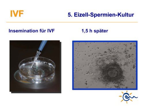 Was ist IVF - Kinderwunsch Praxis Tübingen