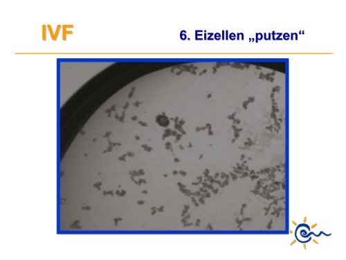 Was ist IVF - Kinderwunsch Praxis Tübingen