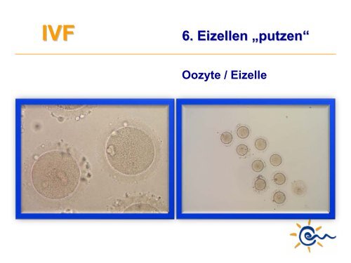 Was ist IVF - Kinderwunsch Praxis Tübingen