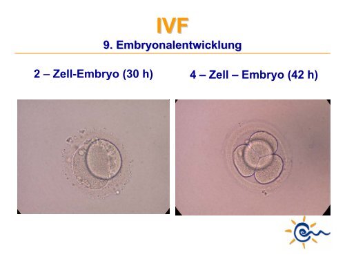 Was ist IVF - Kinderwunsch Praxis Tübingen