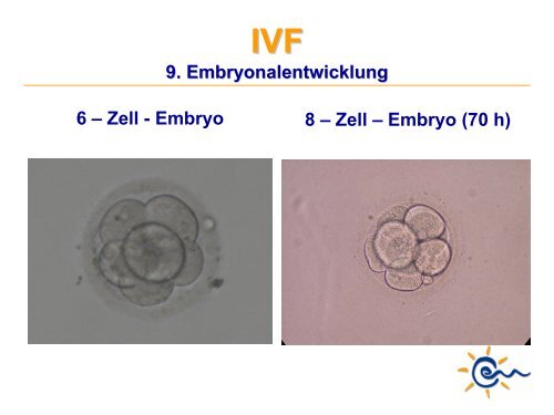 Was ist IVF - Kinderwunsch Praxis Tübingen