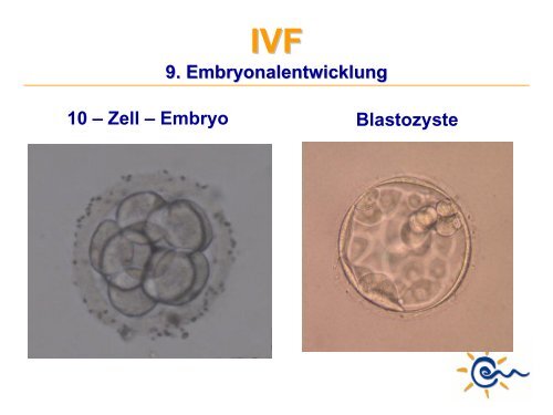 Was ist IVF - Kinderwunsch Praxis Tübingen