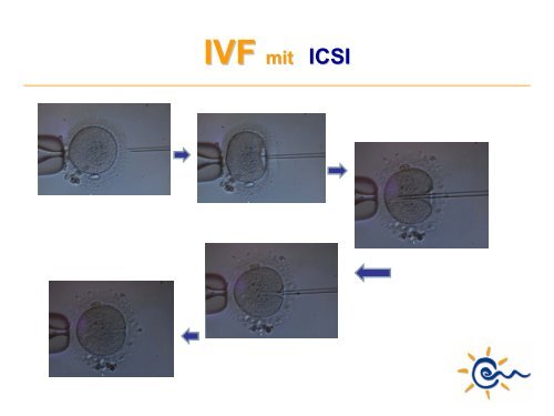 Was ist IVF - Kinderwunsch Praxis Tübingen