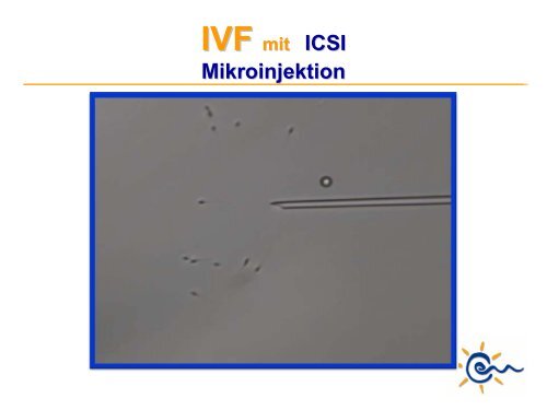 Was ist IVF - Kinderwunsch Praxis Tübingen