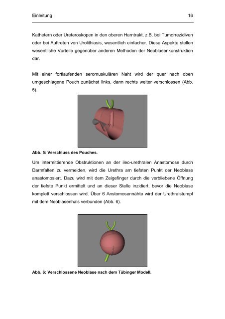 Evaluation perioperativer Parameter sowie der Lebensqualität nach ...