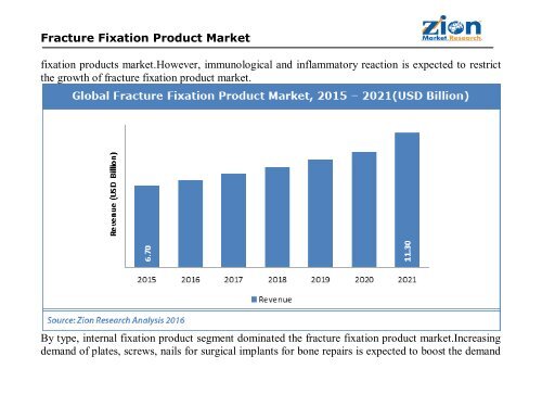 Global Fracture Fixation Product Market will reach USD 11.30 Billion by 2021
