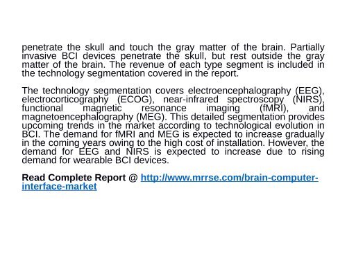 Brain Computer Interface Market : Recent Industry Trends, Current and Projected Industry Size by 2016 - 2024