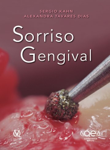 Sorriso Gengival - Sérgio Kahn