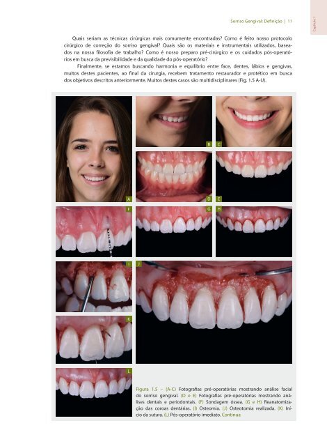 Sorriso Gengival - Sérgio Kahn