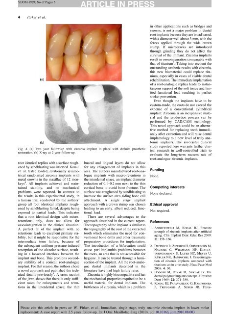 A case report with 2.5 years follow-up