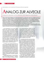 ANALOG ZUR ALVEOLE - BioImplant