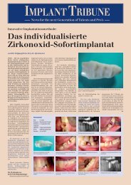 IMPLANT TRIBUNE