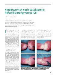 Kinderwunsch nach Vasektomie: Refertilisierung versus ICSI