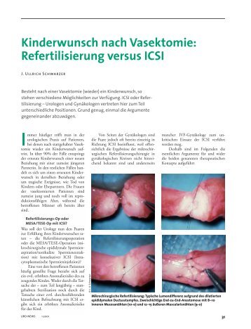 Kinderwunsch nach Vasektomie: Refertilisierung versus ICSI